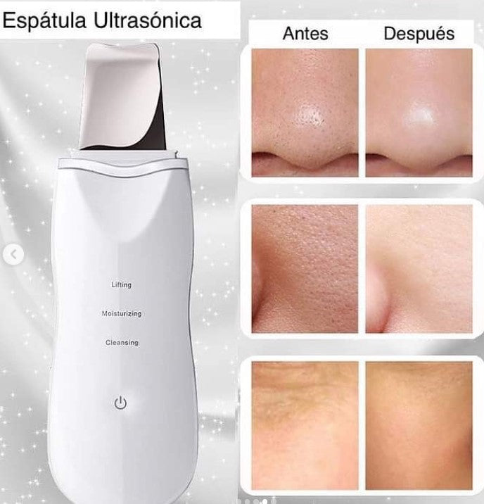 ESPÁTULA FACIAL ULTRASÓNICA LIMPIADORA